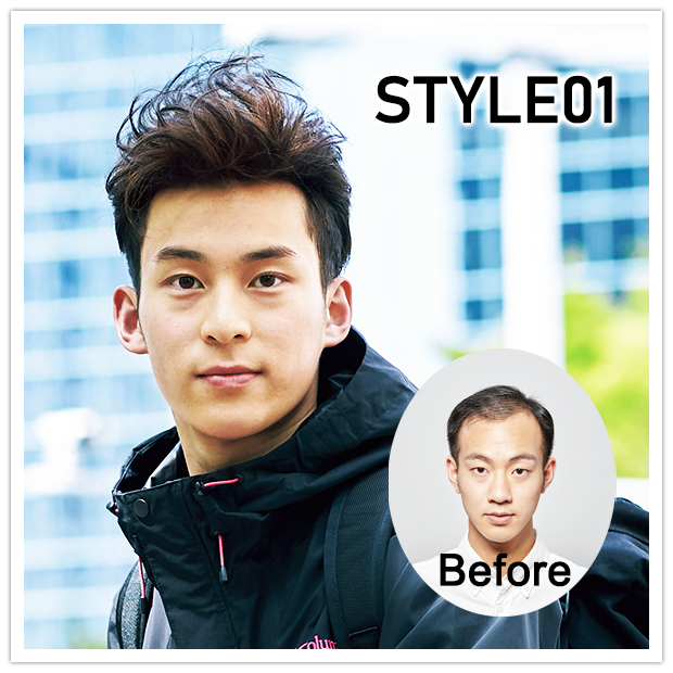 Aderans Pinpoint Style01