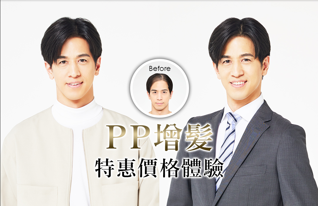 PP增髪 特惠價格體驗