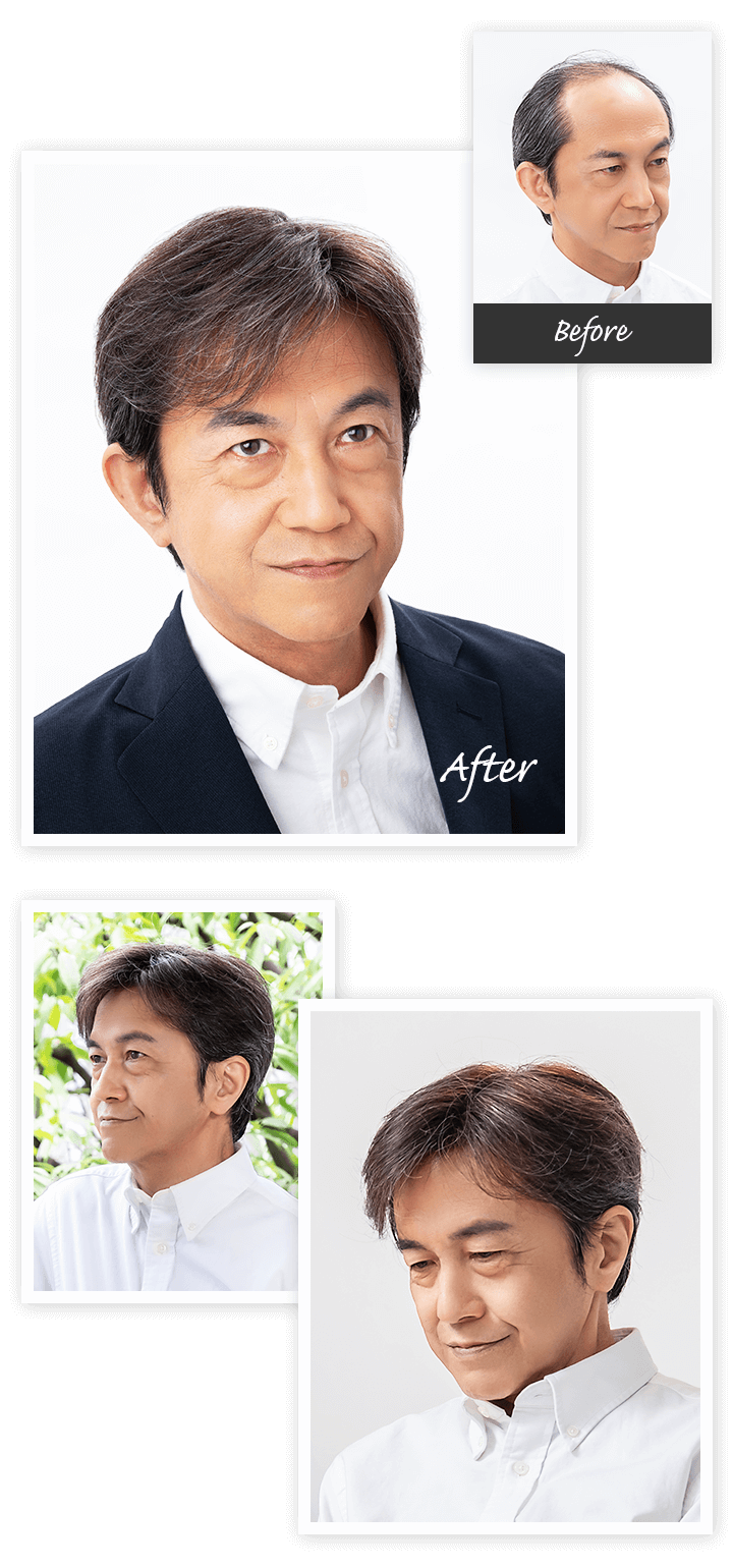 Aderans 假髮 CASE2