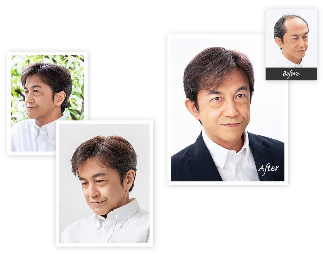 Aderans 假髮 CASE2