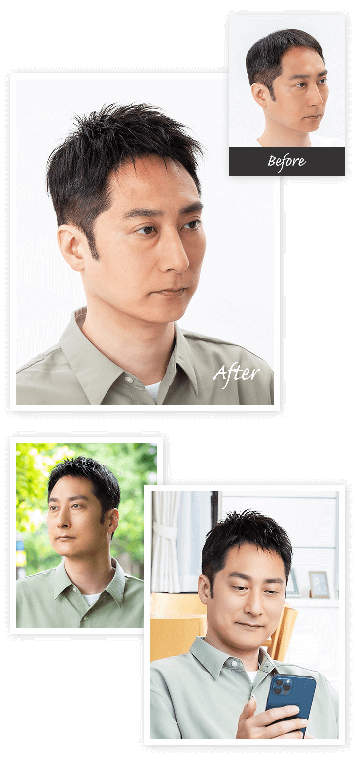 Aderans 假髮 CASE3