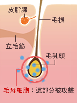 因為抗癌劑不只針對癌細胞，它也會攻擊一般正常細胞