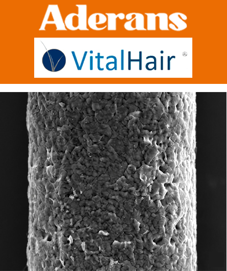 Aderans VitalHair