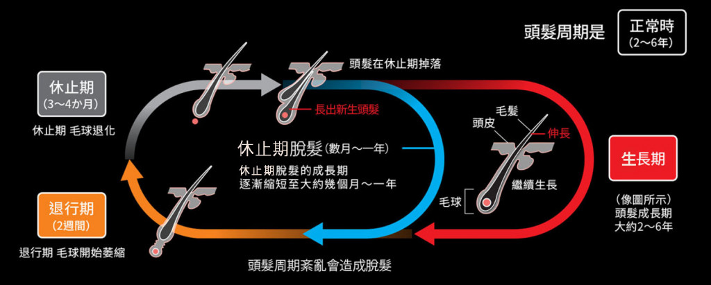 常見的 4 種掉髮類型 頭髮週期圖表